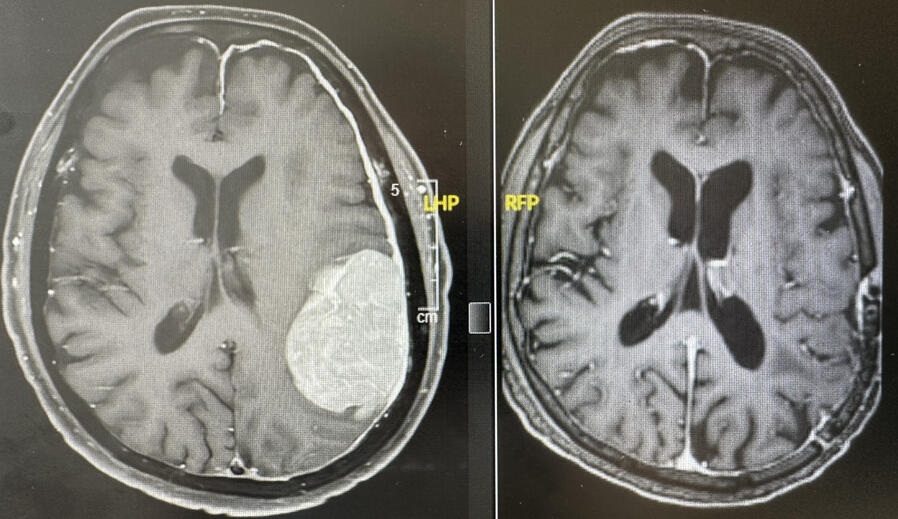 La Sociedad Española de Neurocirugía (SENEC) NEUROCIRUJANO ALICANTE
