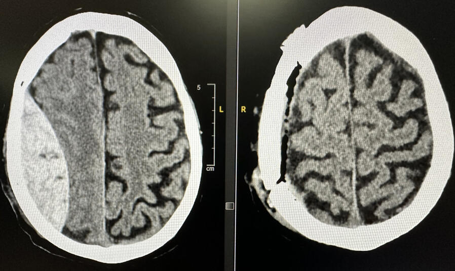 NEUROCIRUJANO ALICANTE